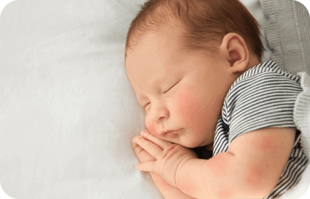 Schlafendes Baby mit roten Wangen | Babyservice